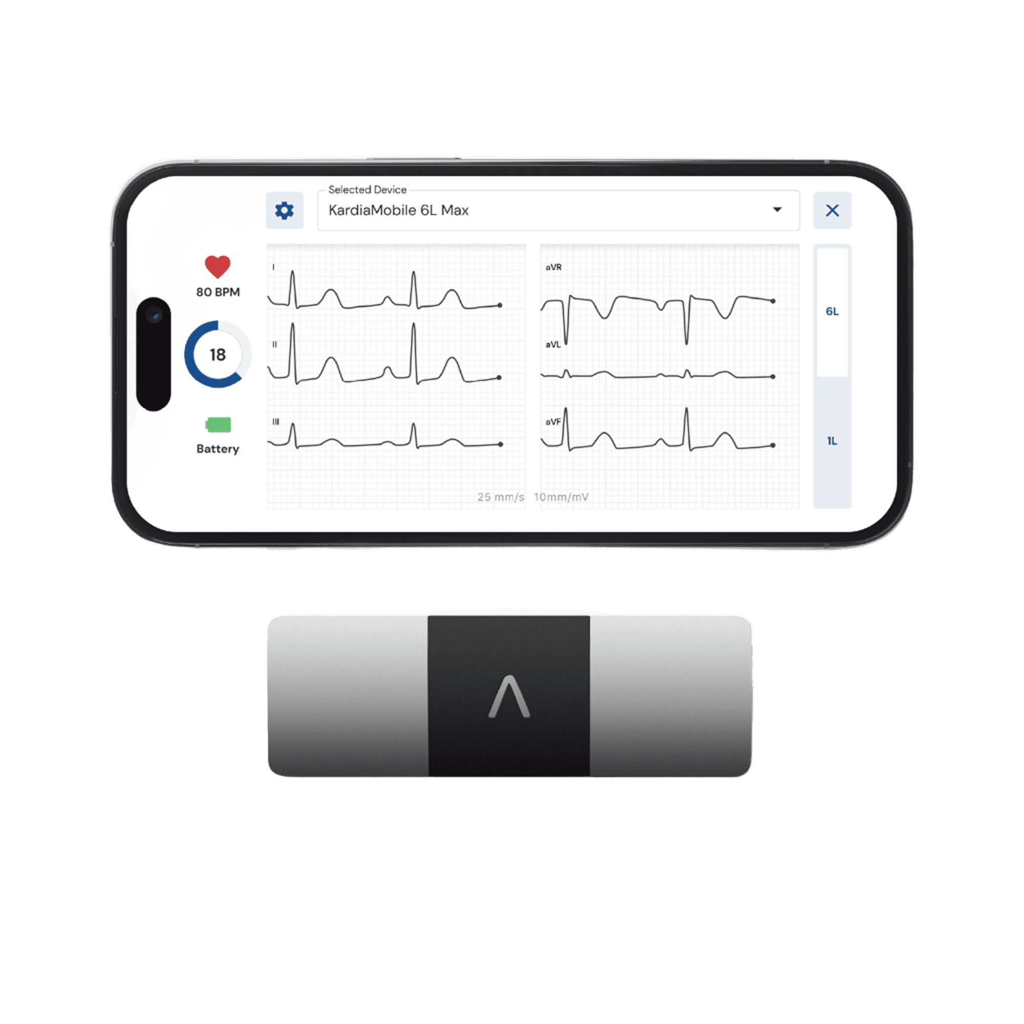 KardiaMobile 6L Max personal EKG