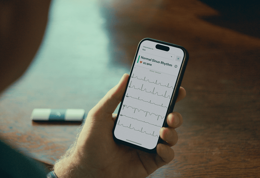 /what-is-an-ekg